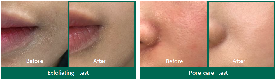 AHA-BHA-PHA 30 days Miracle Toner - tonikas probleminei odai