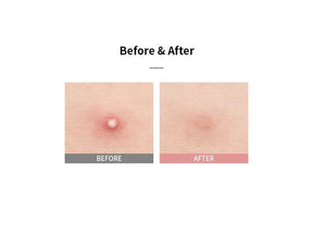 Mediheal A-Zero Shot Trouble Dressing Spot Patch | skinli-lt726498272.webp